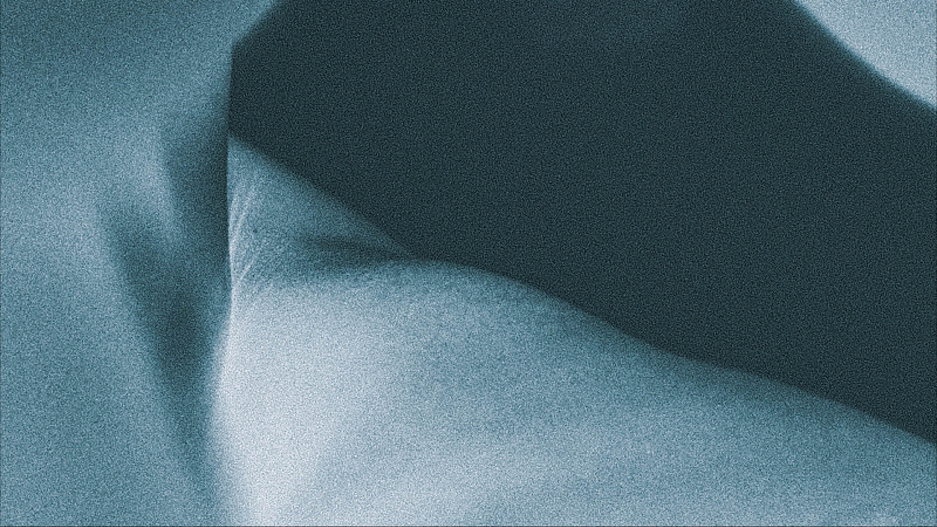 Universtitätspital Zürich